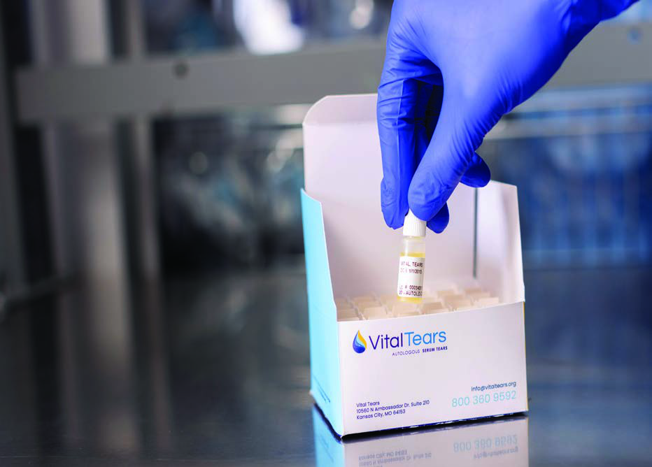 Vital Tears patient care and serum tear therapy