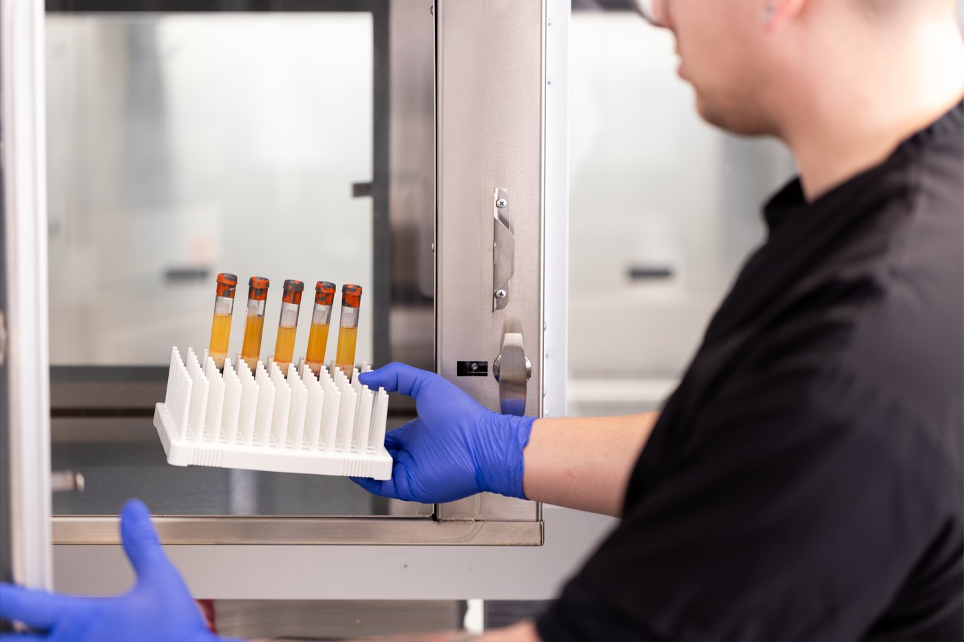 Blood collection and serum tear processing at Vital Tears